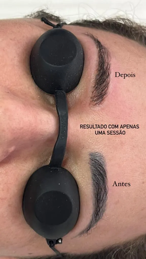 Resultado com apenas uma sessão